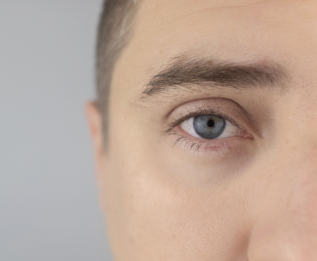 enlever les cernes Image