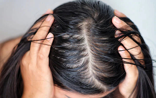 Comment lutter contre les cheveux gras? Découvrez toutes les astuces.